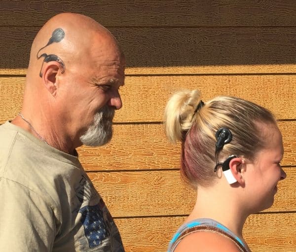 Cochlear implant tattoos