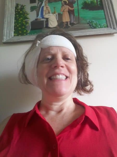 Woman with Usher syndrome post Cochlear Implant surgery