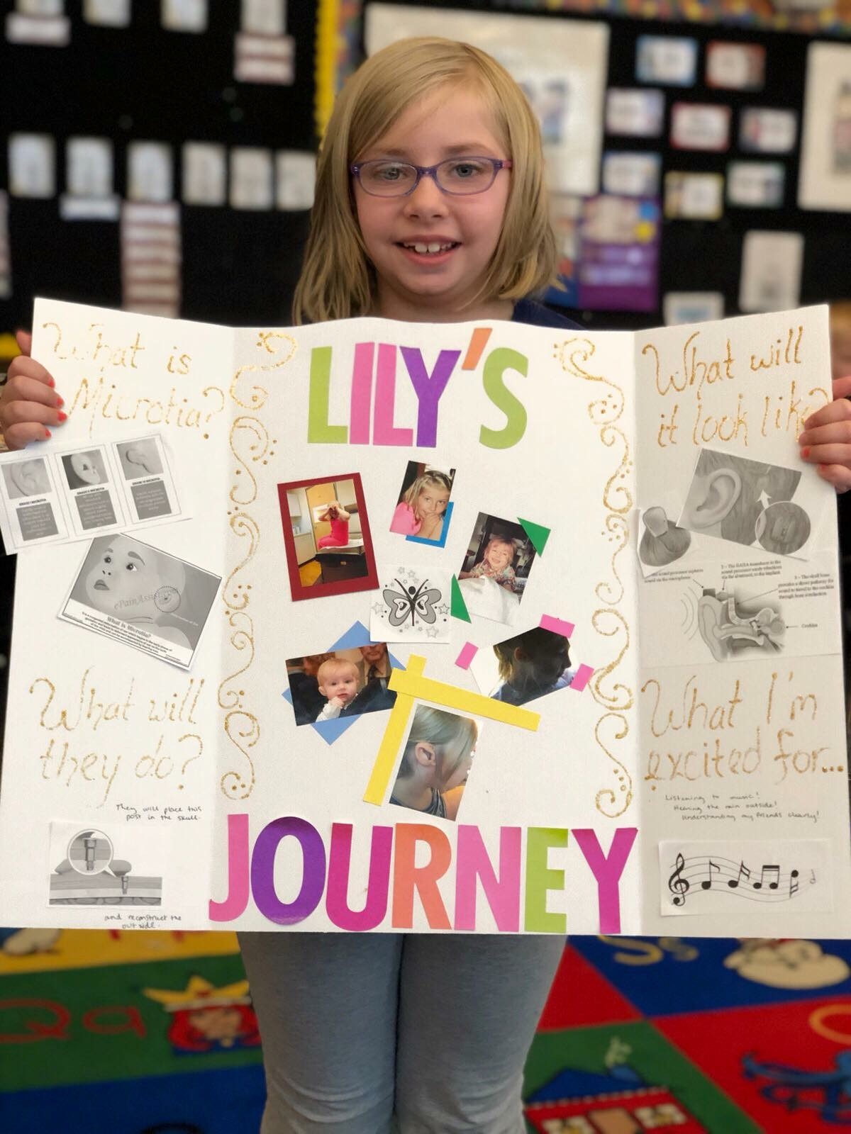 Lily with microtia and atresia with her presentation about her hearing journey