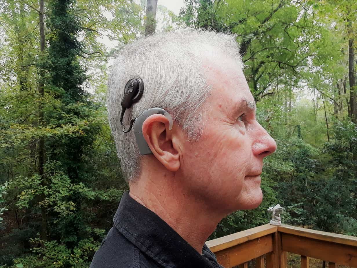 Noel, who has sudden hearing loss, with his cochlear implant sound processor