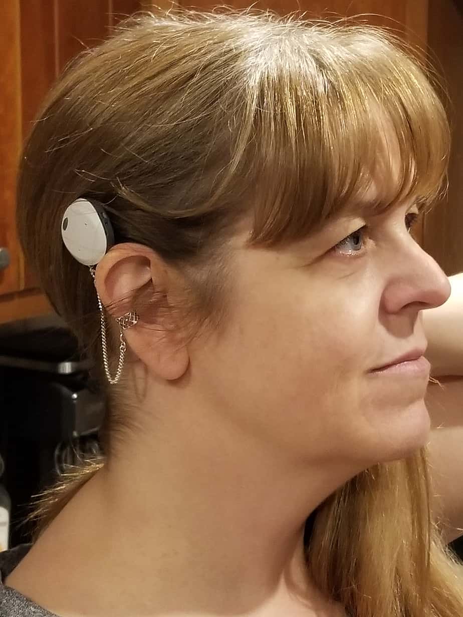 Kim, a woman with single-sided profound hearing loss, with her Osia System