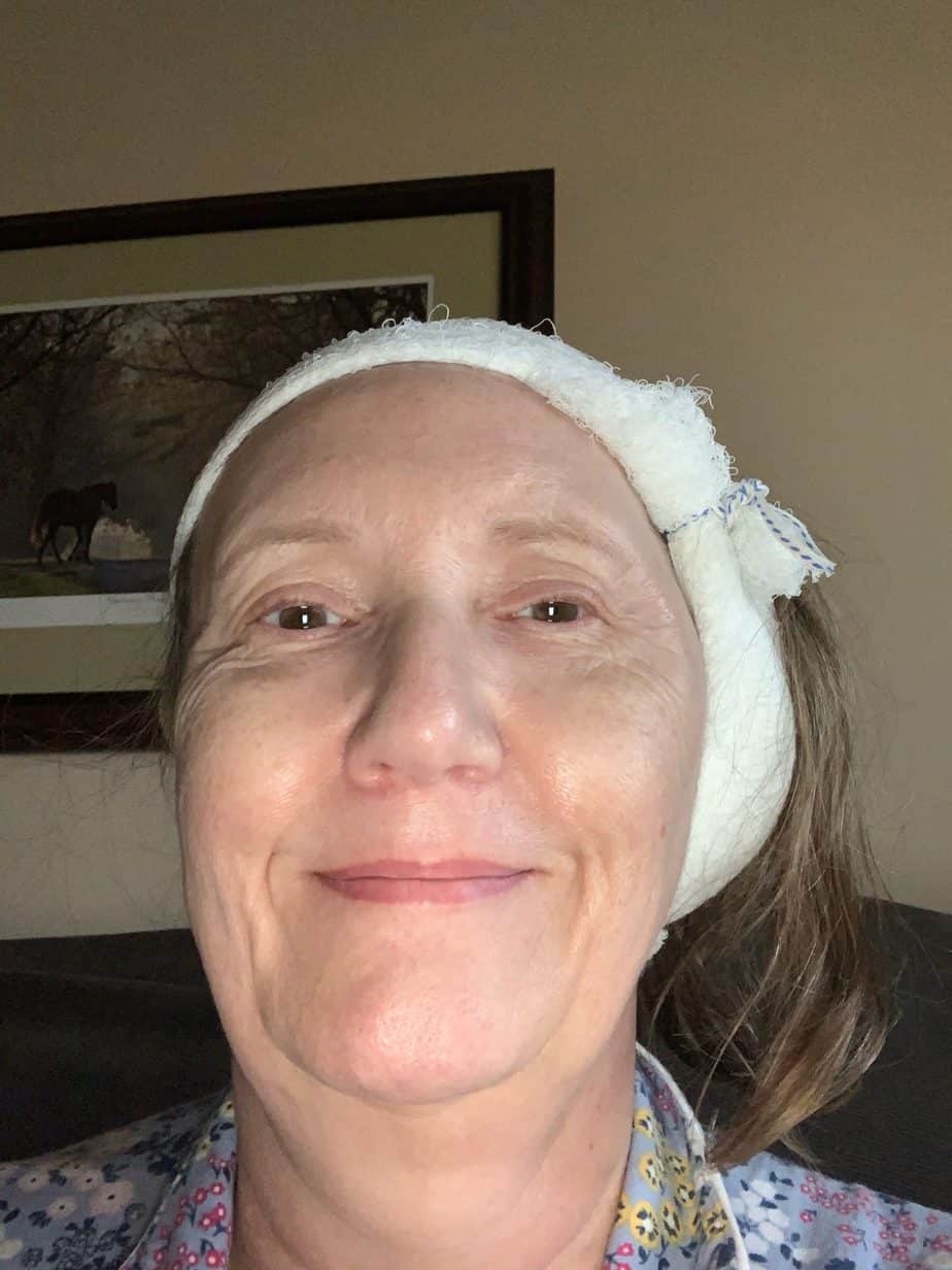 Angela, a Cochlear Osia System recipient, after surgery